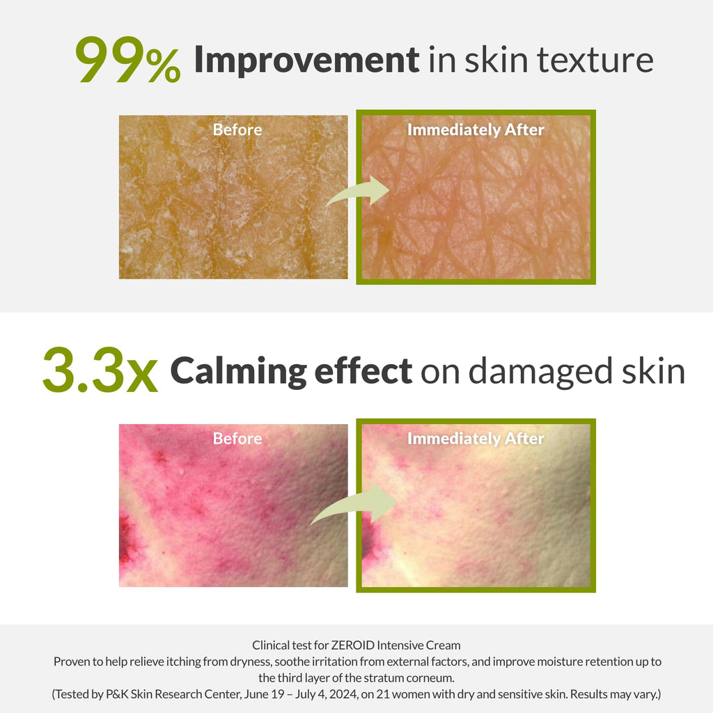 ZEROID | Intensive Cream | Face Moisturizer for Dry & Disordered Skin | Face Cream for Sensitive Skin | Face Lotion For Skin Barrier Repair | Korean Skincare | Korean Moisturizer | 2.7 fl oz (80ml)