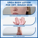 OUKEYA Urea Cream for Dry Chapped Skin with 10% Urea Deep Moisturizer Body Lotion, Softens & Soothes Hands Elbows Feet Hydrates Locks in Moisture, Fast Absorbing & Non-Greasy, 11.28 oz Large Capacity