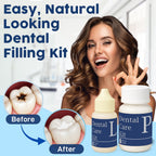 Zinc Oxide Eugenol Dental Cement Tooth Repair kit for Broken Teeth, Temporary Filling for Crowns, Tooth Filler, Cavity Filler for Teeth