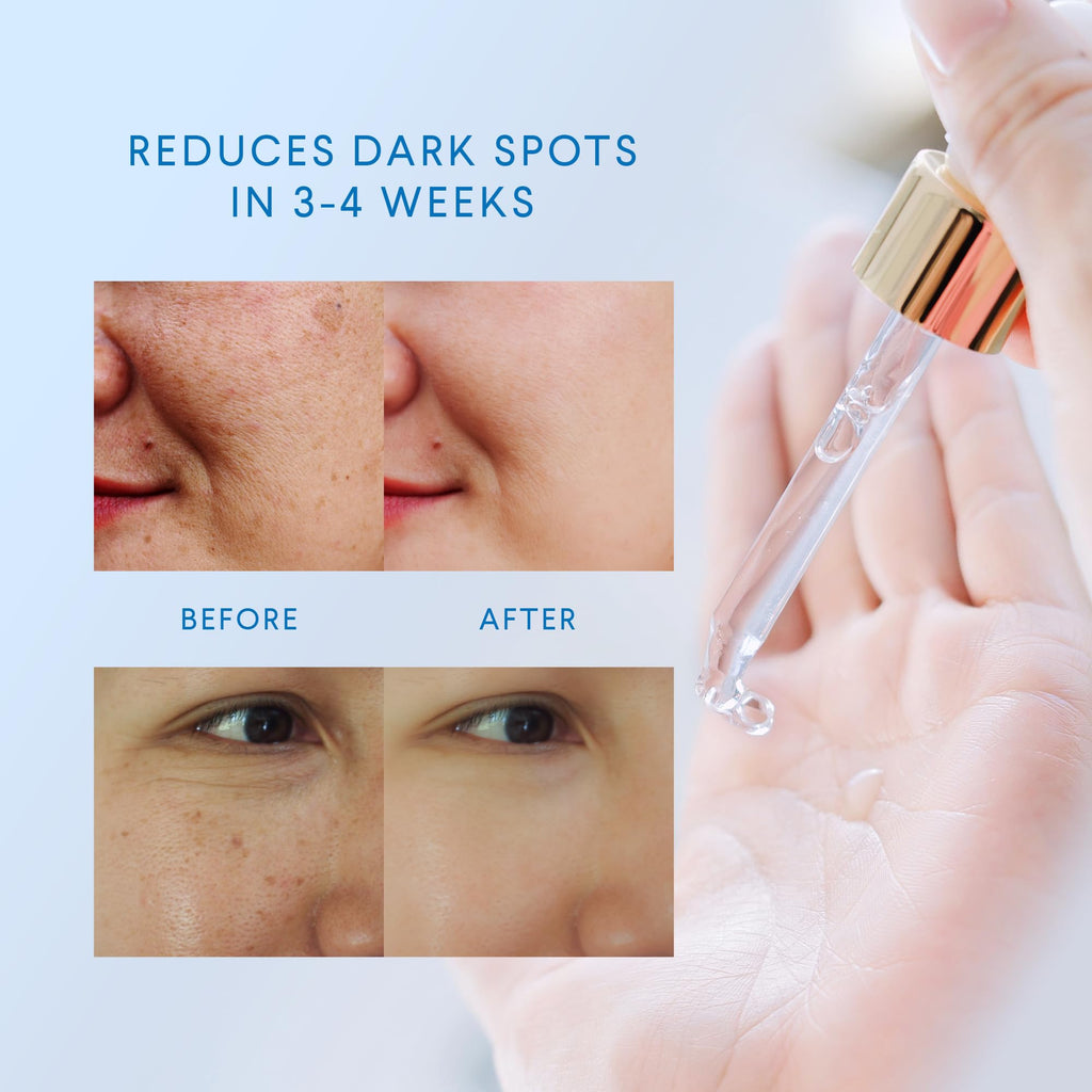 Dark Spot Remover for Face: Dark Spot Remover for Body - Dark Spot Corrector - Dark Spot Serum - Dark Spot Correcting Glow Serum - for Women & Men - 1 FL OZ