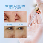 Dark Spot Remover for Face: Dark Spot Remover for Body - Dark Spot Corrector - Dark Spot Serum - Dark Spot Correcting Glow Serum - for Women & Men - 1 FL OZ