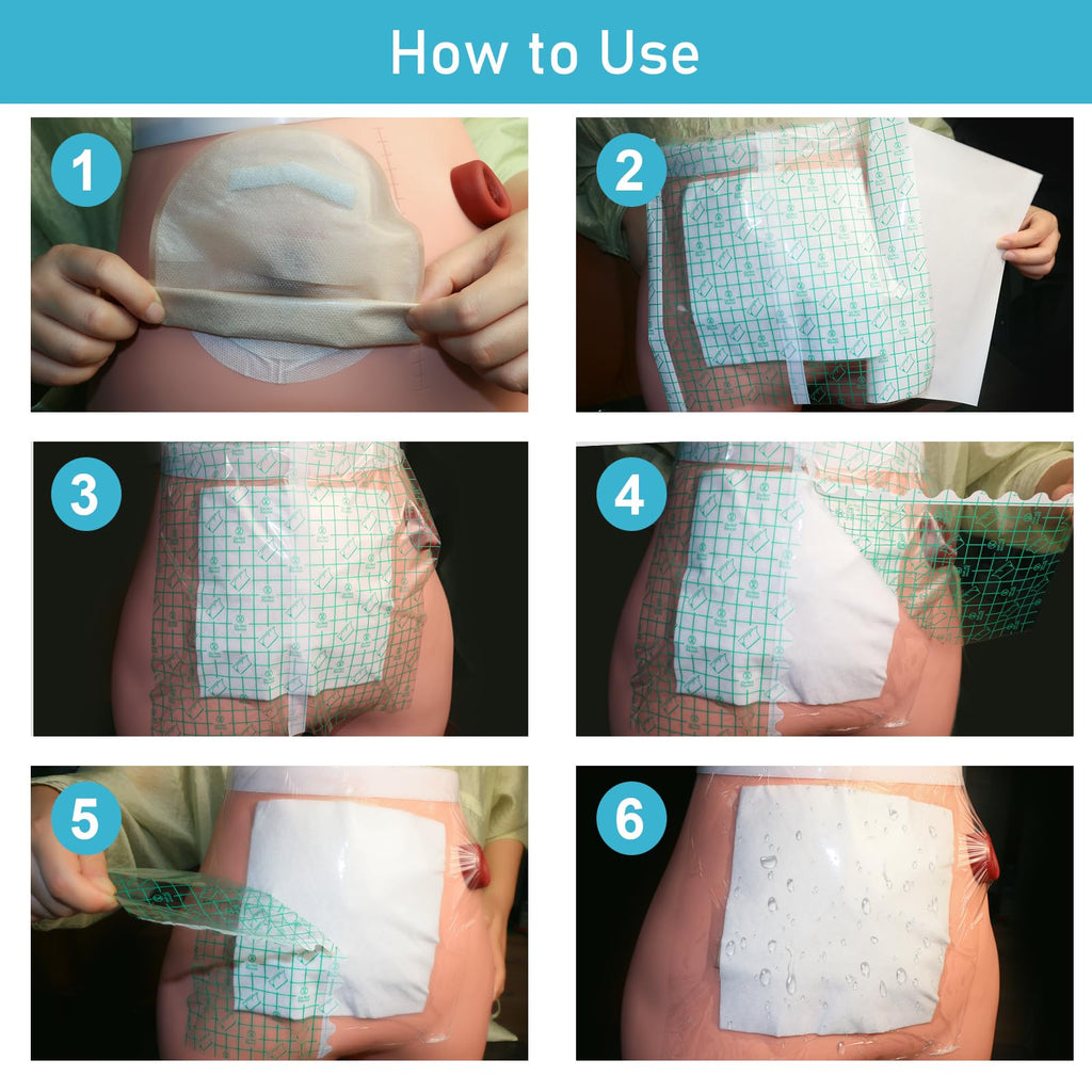 KONWEDA 25 Pcs Waterproof Ostomy Bag Shower Cover 10"x10", Stoma Bath Protector Shield Film Adhesive Dressing Bandage for Ostomy Supply Guard Accessory