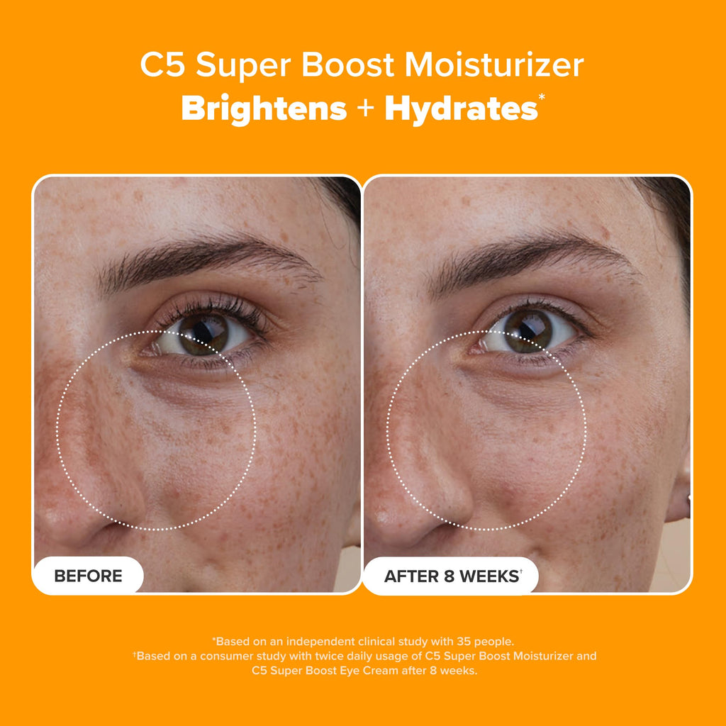 Paula's Choice C5 Super Boost Face Moisturizer with 5% Vitamin C & Squalane, Daily Face Lotion for Discoloration, Uneven Tone, Fine Lines & Breakout-Prone Skin, Fragrance-Free, 1.7 Fl Oz