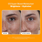 Paula's Choice C5 Super Boost Face Moisturizer with 5% Vitamin C & Squalane, Daily Face Lotion for Discoloration, Uneven Tone, Fine Lines & Breakout-Prone Skin, Fragrance-Free, 1.7 Fl Oz