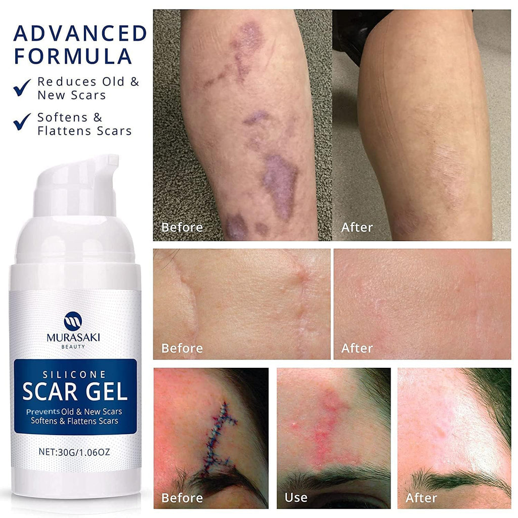 100% Silicone Scar Gel Scars Cream - Advanced Scar Gel for Surgical Scars, C-Section, Stretch Marks, Acne, Injury, Burns, Keloids, Old and New Scars 1.06oz(30g) (Maximum Strength 100% Silicone)