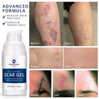 100% Silicone Scar Gel Scars Cream - Advanced Scar Gel for Surgical Scars, C-Section, Stretch Marks, Acne, Injury, Burns, Keloids, Old and New Scars 1.06oz(30g) (Maximum Strength 100% Silicone)