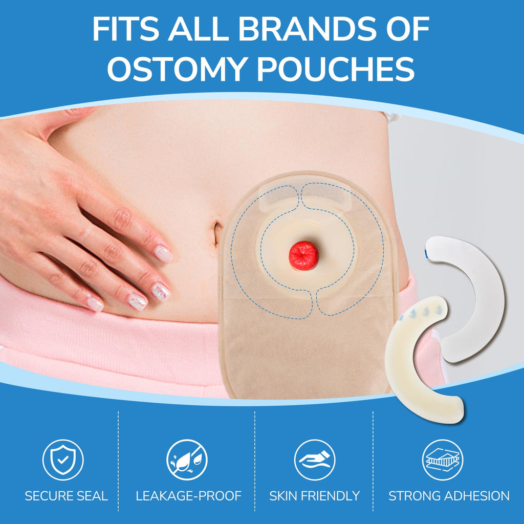 Heagimed 20PCS Ostomy Barrier Strips, Skin-Friendly Hydrocolloid Skin Barrier Strips, Elastic Barrier Strips for Ostomy Bag Ostomy Colostomy Ileostomy Supplies