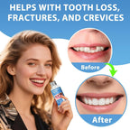 Tooth Repair Kit, Moldable False Teeth Beads for Teeth Repair, Suitable for Missing, Cracked DIY Denture Kit, 1Pack