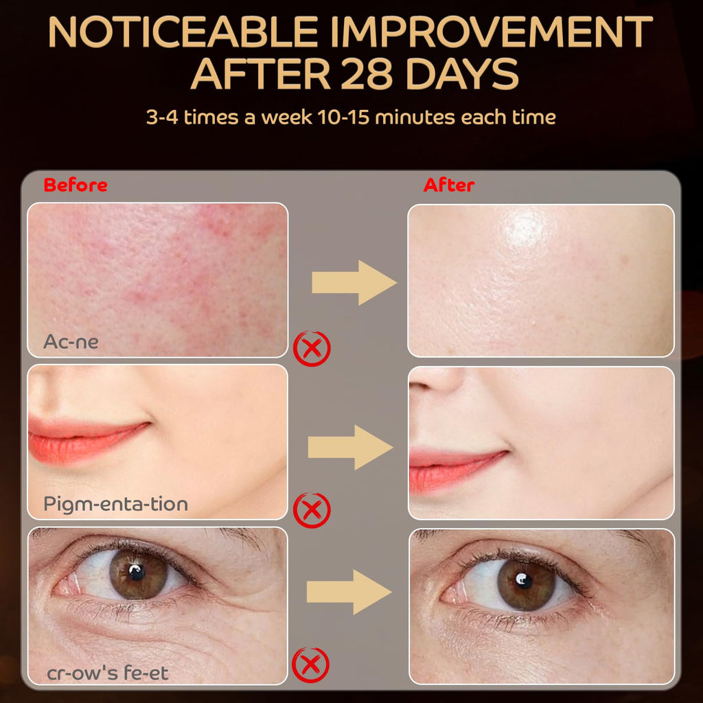 Red Light Therapy for Face, LED Face Mask Light Therapy 660 & 850 Wavelength for Reduce Fine Lines and Wrinkles Facial Care