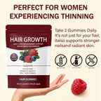 FORTIRISE Lumin Hair Growth Gummies – Biotin, Vitamins & Plant Extracts, Supports Healthy Hair Growth & Strength, Skin & Nail Care - Mixed Berry Flavor, 60 Gummies