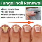Ginger Toenail Fungus Treatment, Fungal Nail Treatment, Ginger Nail Growth Serum,7 Days Nail Treatment, Antifungal Nail Repair Serum, Fast-Acting Recovery for Thick, Discolored, Yellow Nails