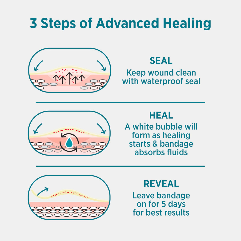 BAND-AID Brand Pro Heal 5 Day Protect, Ultra-Thin Hydrocolloid 100% Waterproof First Aid Adhesive Bandages for Advanced Healing and Less Scarring Versus Uncovered Wound, Large Size, 6 ct