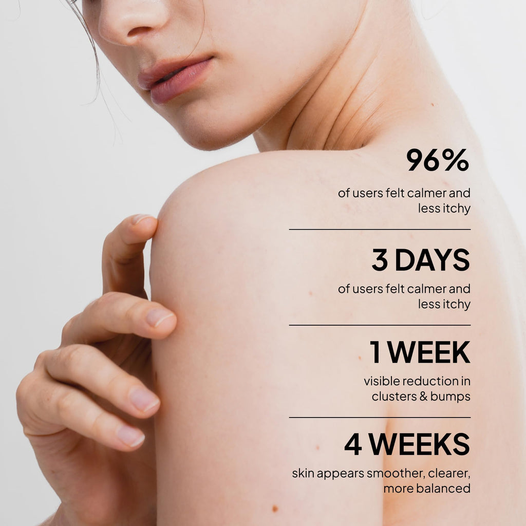 BellamiLuxx Fungal Acne Treatment Lotion: Effective Face & Body Pimple Cream for Bumps, Clusters, Itch & Redness – Fungal Prone Skin Acne Treatment Moisturizer for Teens & Adults with Natural Actives