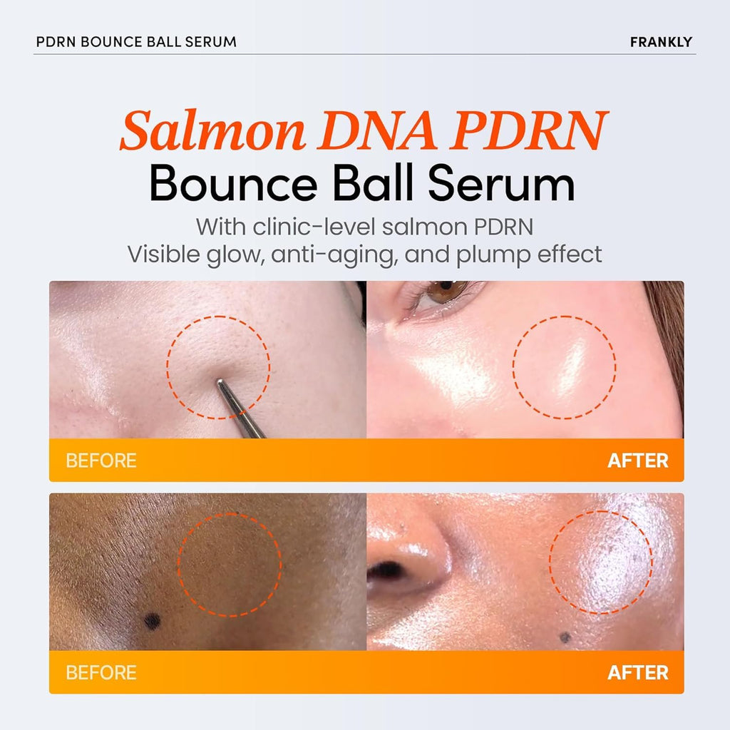 FRANKLY Salmon PDRN Bounce Ball Serum – 99% Pure PDRN Salmon DNA for Post Microneedling Recovery, Redness & Damaged Skin Repair | Glass Skin Korean Skincare | Lightweight, Non Sticky | 1.01 fl oz