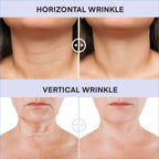 DERPHEA Neck Tightening Cream, Neck Cream, Face Firming Cream For Tightening & Firming Skin, Fine lines, Loose & Sagging On Neck, Decollete Or Other Skin Areas (Package may different)