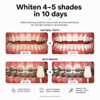 Opalescence Go 15% Mint - Prefilled Teeth Whitening Trays - 5194