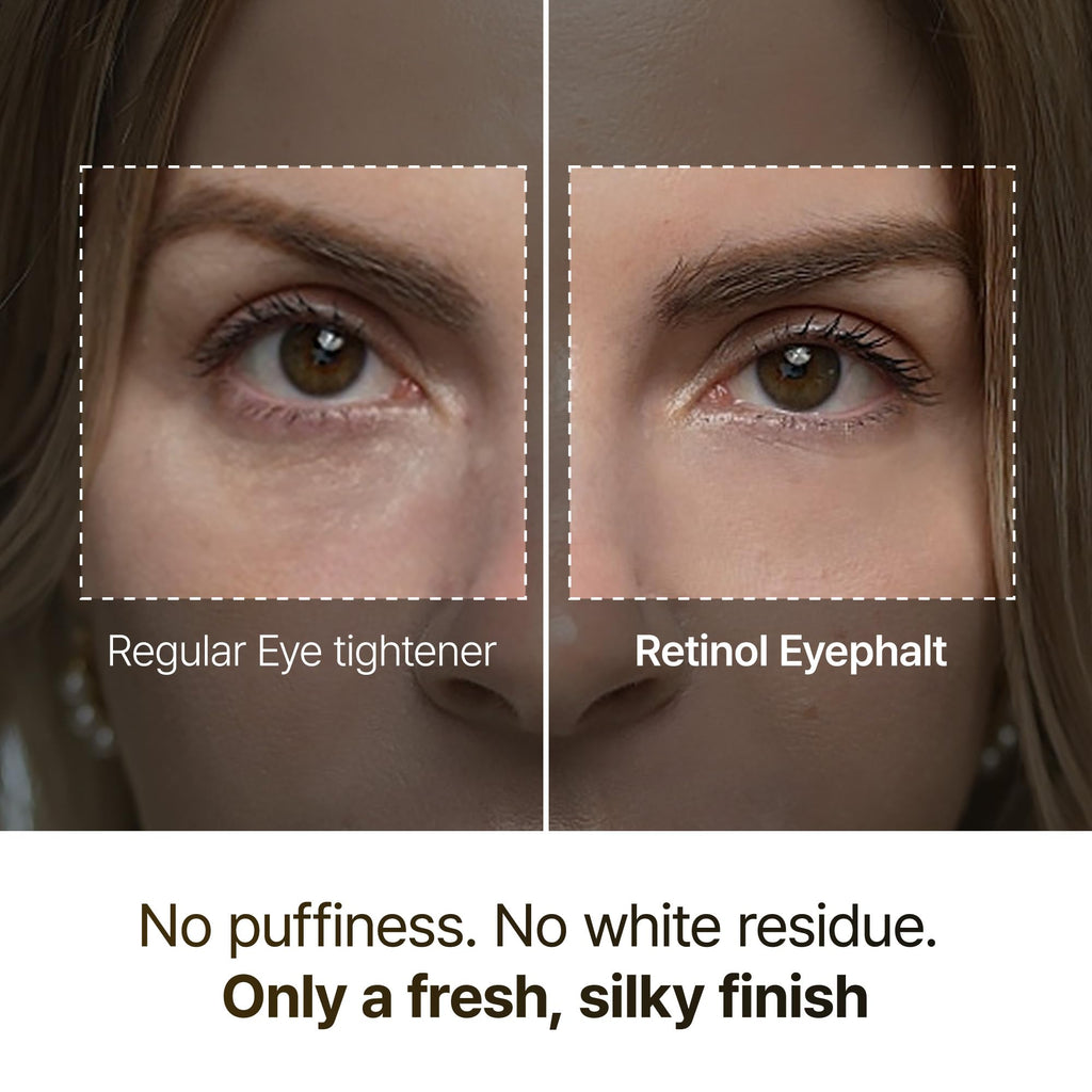 Dr.Melaxin Retinol Eyebag Cream for Puffiness, Dark Circles & Fine Lines, Wrinkle, EGF Anti-Aging Under Eye Moisturizer with Niacinamide&Ceramide Makeup friendly korean skin care