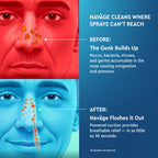 Navage® Nasal Irrigation System Deluxe Bundle, Nose Cleaner for Congestion Relief w/ 30 SaltPods, Storage Caddy, Black Travel Bag & Batteries ($137 Value). Sinus Rinse for Clinically Proven Benefits