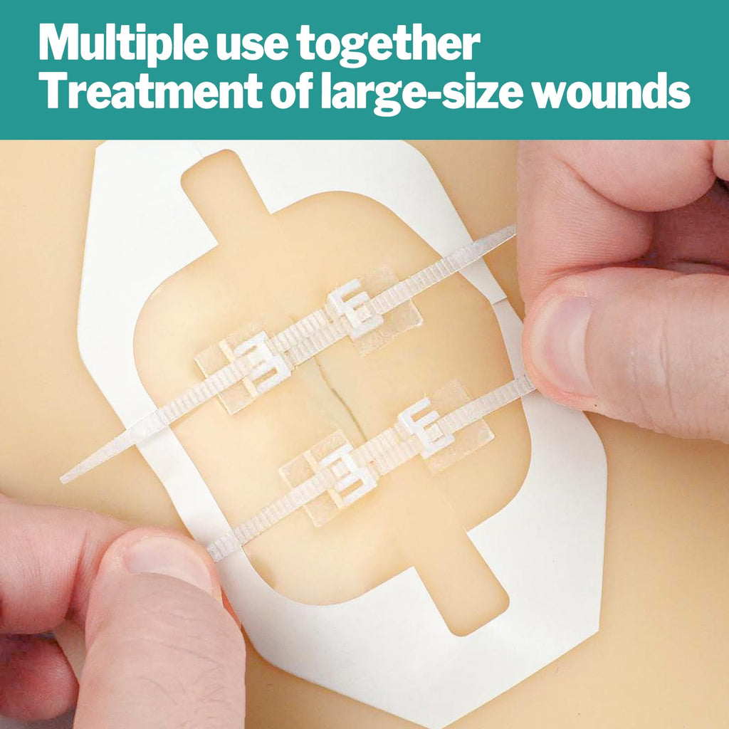 AZEN 10 Pack Emergency Wound Closure Strips, Butterfly Bandages for Wound Closure, Quick Clot Zip Stitch Wound Closures Device