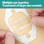 AZEN 10 Pack Emergency Wound Closure Strips, Butterfly Bandages for Wound Closure, Quick Clot Zip Stitch Wound Closures Device