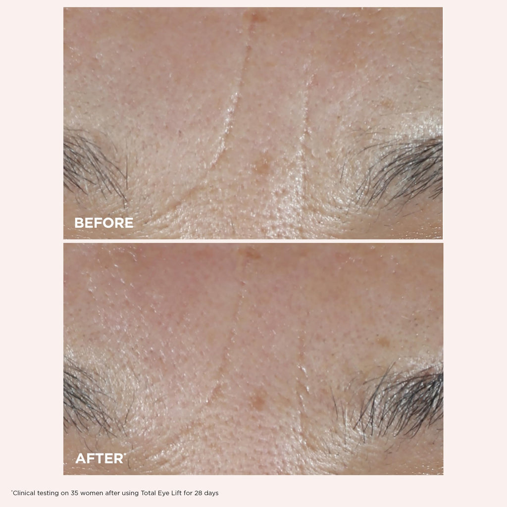 Clarins Total Eye Lift | Anti Aging Eye Cream | Targets Wrinkles, Crow's Feet, Dark Circles and Puffiness For a Visible Eye Lift in 30 Seconds
