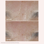 Clarins Total Eye Lift | Anti Aging Eye Cream | Targets Wrinkles, Crow's Feet, Dark Circles and Puffiness For a Visible Eye Lift in 30 Seconds