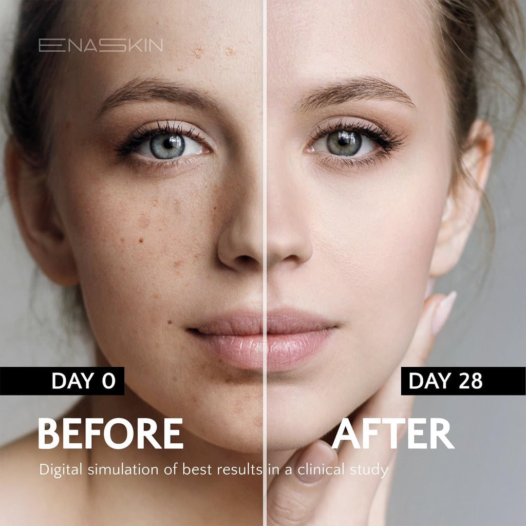 Enaskin Dark Spot Set - Serum & Soap Bars: Hyperpigmentation Body Treatment for Freckles Melasma Age Spot Sun Spot - Dark Spots Corrector Serum with Kojic Acid Soap Bars for Women and Men