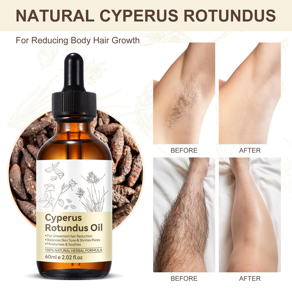 Premium Cyperus Rotundus Oil 2PCS - Reducing Body Hair Growth | 100% Pure Cyperus Rotundus Essential Oil for Smooth Skin & Hair Removal, 60ml