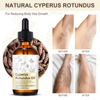 Premium Cyperus Rotundus Oil 2PCS - Reducing Body Hair Growth | 100% Pure Cyperus Rotundus Essential Oil for Smooth Skin & Hair Removal, 60ml