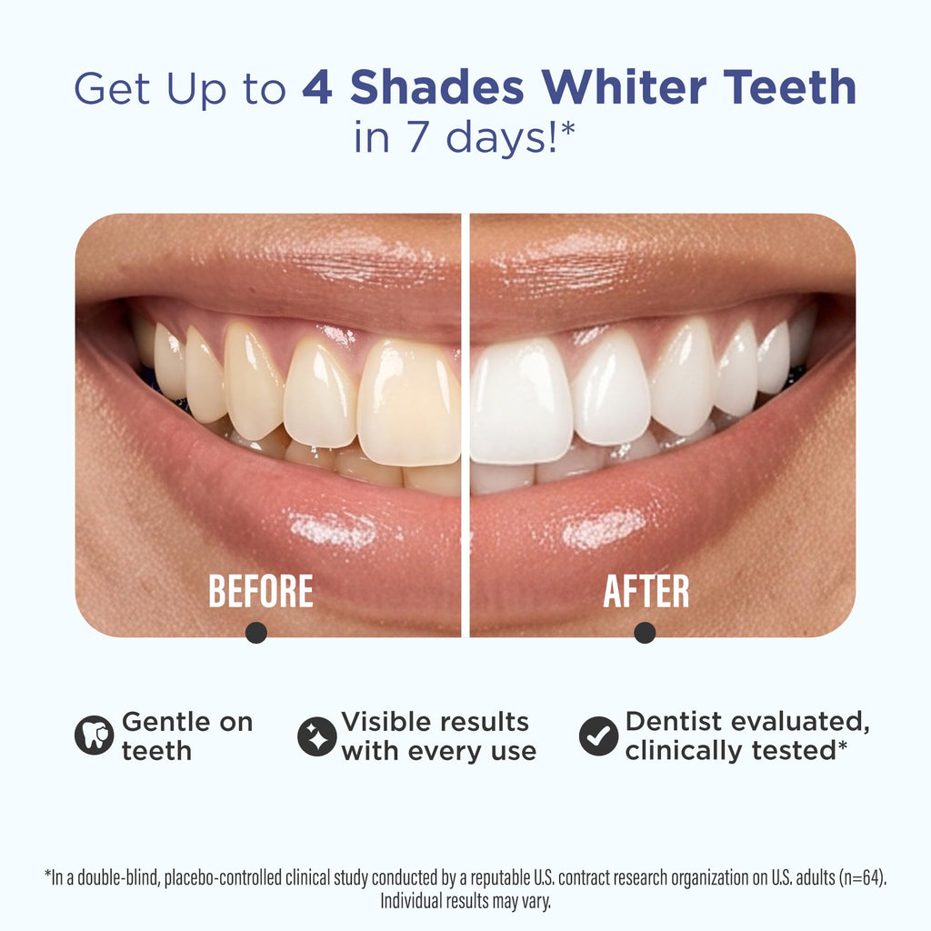 GuruNanda Teeth Whitening Strips - 4X Whiter Teeth, 16-Day Whitening Kit