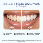 GuruNanda Teeth Whitening Strips - 4X Whiter Teeth, 16-Day Whitening Kit