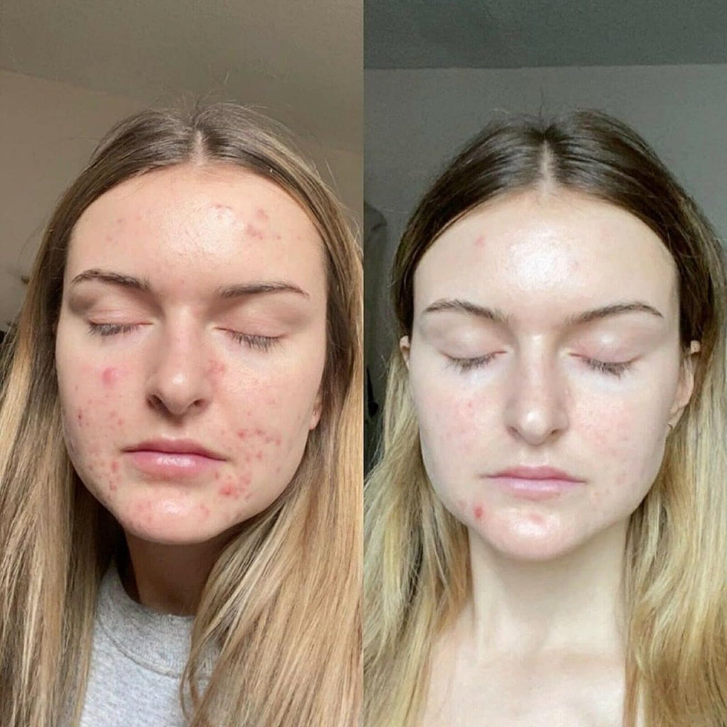 Retinol Gel 0.1 Vitamin A Repairs Fine Lines & Wrinkles, Scar Treatment, Age and Sun Spots, Anti-Aging Formula Gel 20 Grams