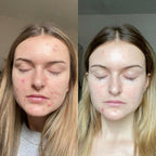 Retinol Gel 0.1 Vitamin A Repairs Fine Lines & Wrinkles, Scar Treatment, Age and Sun Spots, Anti-Aging Formula Gel 20 Grams
