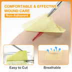 Carbou Medical Xeroform Petrolatum Dressing 2"x2", 25 Pack, Non-Stick Gauze