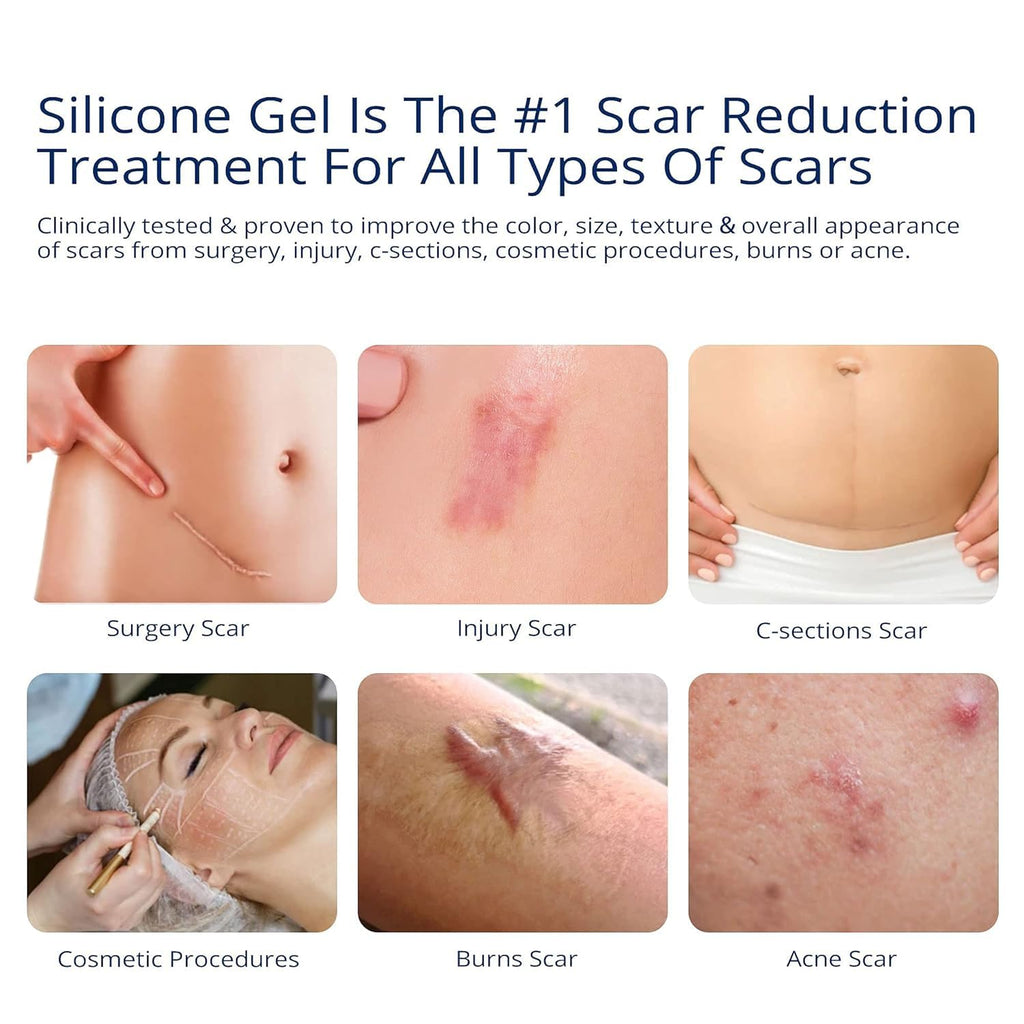 100% Silicone Scar Gel Scars Cream - Advanced Scar Gel for Surgical Scars, C-Section, Stretch Marks, Acne, Injury, Burns, Keloids, Old and New Scars 1.06oz(30g) (Maximum Strength 100% Silicone)