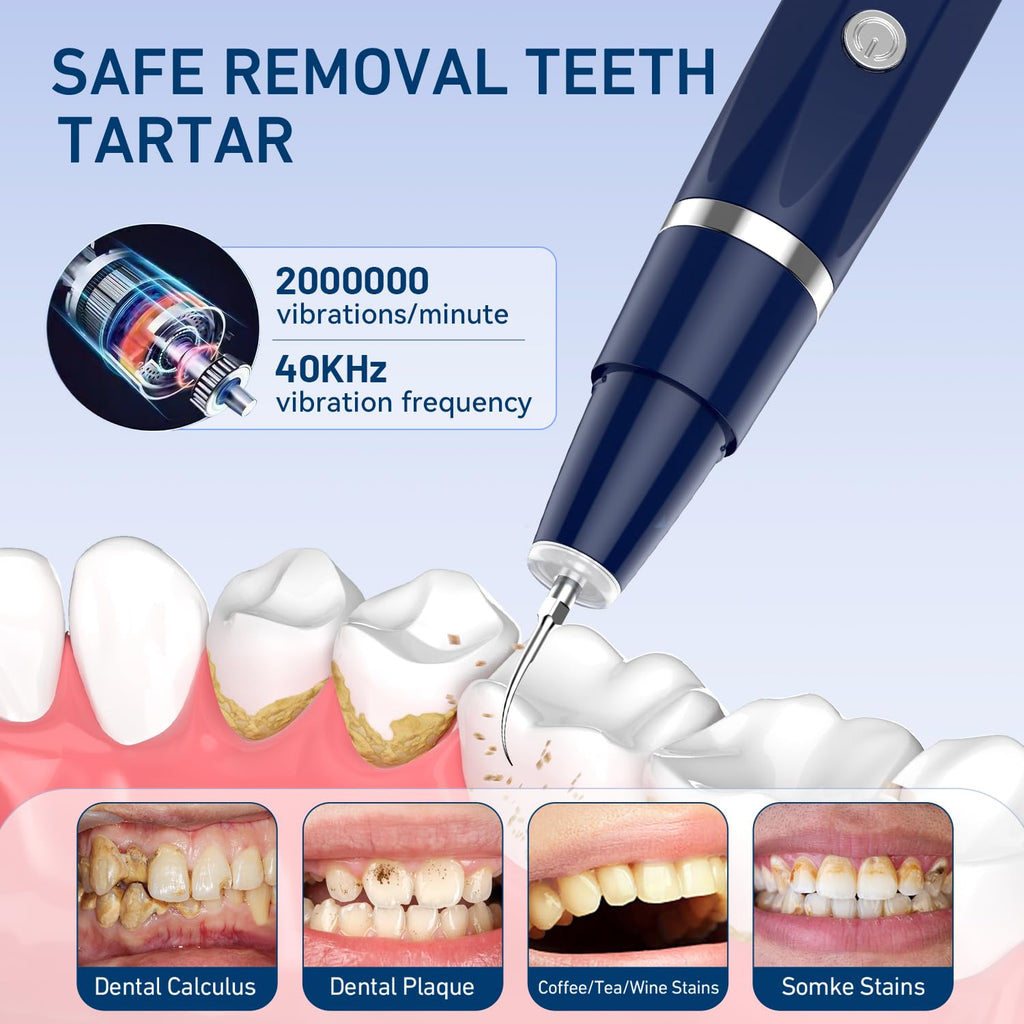 Plaque/Tartar Remover for Teeth, Dental Calculus Remover Teeth Cleaning Kit with LED Light & 5 Adjustable Modes