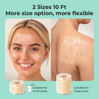 TKTK Hydrocolloid Roll 2 Sizes, Cut-to-Fit Bandages for Pimple & Wounds