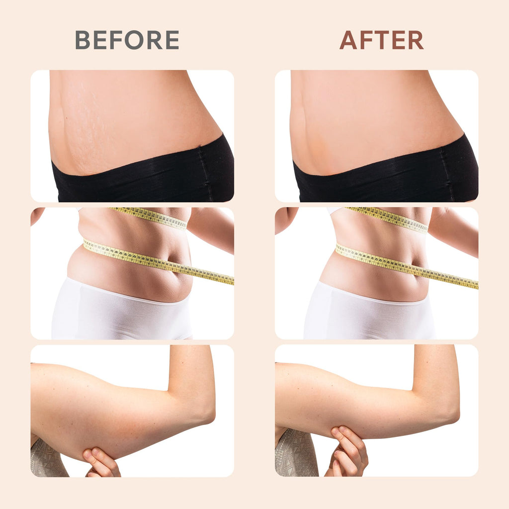 Depsoul Cellulite Massager, Upgraded Body Sculpting Machine 4 in 1 Wireless Cellulite Remover with 4 Modes 10 Levels for Belly, Waist, Arm, Leg, Butt,Rose Gold