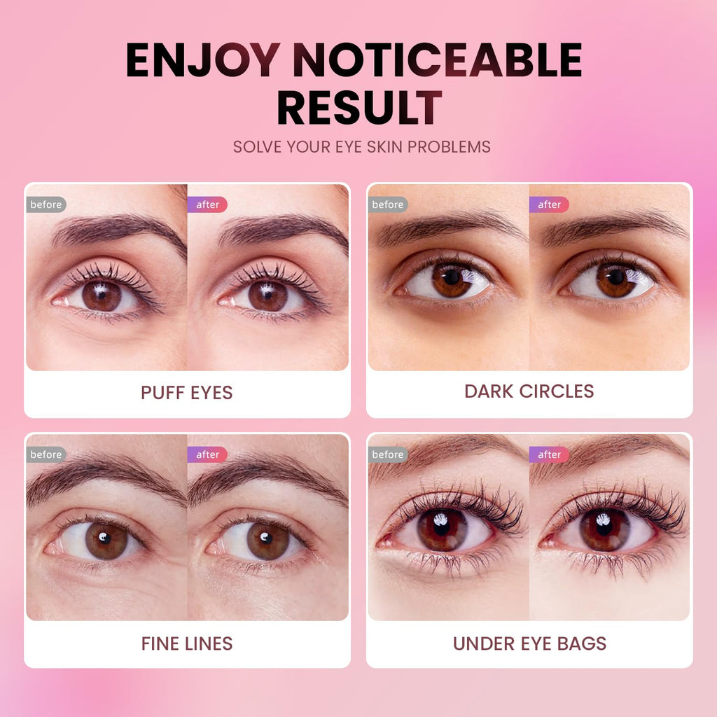 AILEORY Under Eye Patches (36 Pairs) - Tri-color Glitter Eye Gel Pads for Dark Circles, Puffy Eyes, Under eye Bags, Wrinkles | Natural Collagen Under Eye Mask Patches, Gel Under Eye Patches