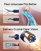 Bebird D39R Ear Wax Removal: Ear Camera with Storage Case&Painless Tweezers