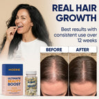 Moerie Ultimate Hair Growth Supplements for Women & Men - Hair, Skin, Nails Vitamins with Biotin & Minerals - for Thicker, Fuller Hair & Hair Loss Treatment - 120 Capsules