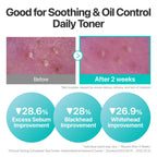 numbuzin No.1 Toner | Pure-Full Calming Herb Toner | Breakouts, Redness, Excess Oil Control | Centella Asiatica, Heartleaf, Licorice Root | Acne-Prone, Sensitive Skin | 10.14 fl. oz.