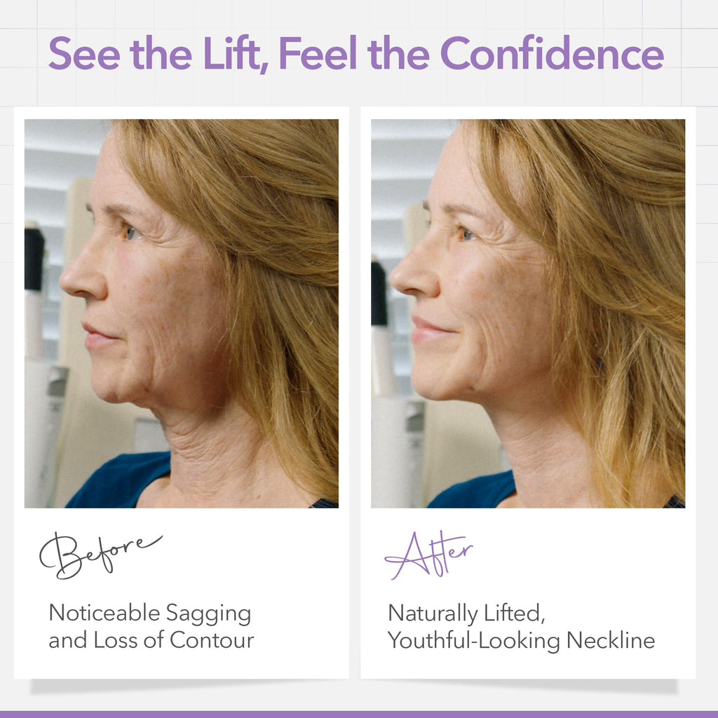 Neck Less George NECK LESS Professional Face Lift Strips – Instant Jawline & Neck Lift ...