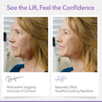 NECK LESS Professional Face Lift Strips – Instant Jawline & Neck Lift Tape | Medical-Grade, Invisible, Waterproof Skin-Tightening Solution | Non-Surgical Facial Tape Kit, 10-Hour Hold (25 Strips)