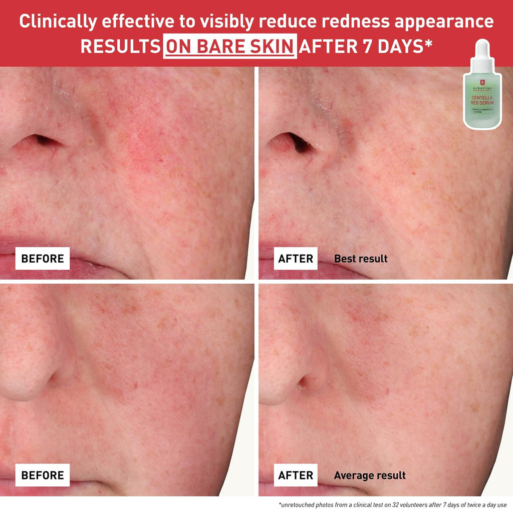 CENTELLA RED SERUM 30ML