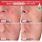 CENTELLA RED SERUM 30ML