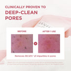 SKIN1004 Poremizing Deep Cleansing Foam, 4.23 fl.oz, 125ml, Makeup Remover, Korean Face Cleanser with Himalayan Pink Salt & Madagascar Centella Asiatica for Facial Pore Cleansing, Korean Skin Care