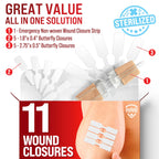 Emergency Wound Closure Strip - Laceration Closure Kit - Stitchless & Easy to Use - Butterfly Bandage