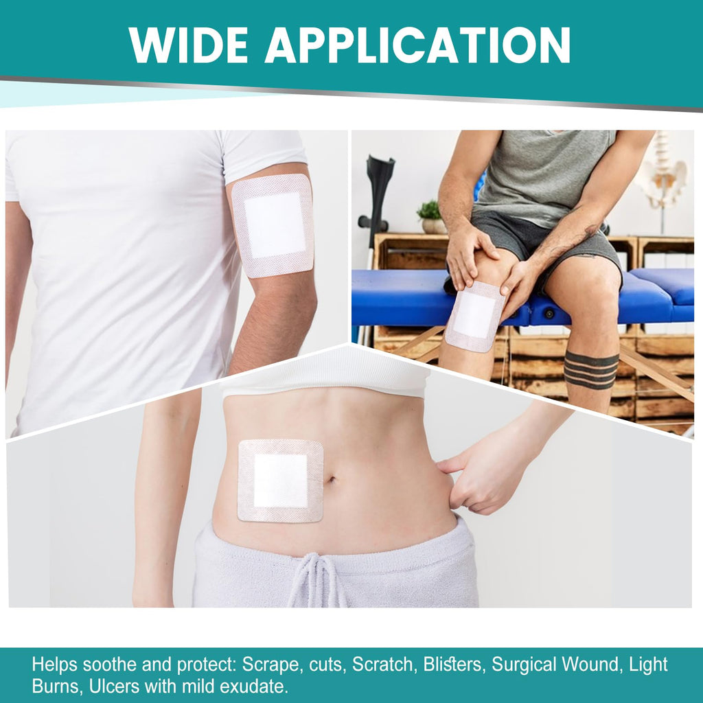 50 Count Island Dressing Bordered Gauze 4" x 4", Gauze Pads Individually Wrapped, Non-Stick Pad in Center with Adhesive Border, Bandages for Wounds, First Aid
