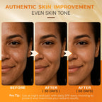 QOOQ Turmeric Kojic Acid Soap for Dark Spots Remover – Facial Cleansing Bar with Vitamin C, Retinol, Collagen, Vitamin E, Glycerin, Shea Butter & Castile Olive Oil – Soap for Women & Men (120g x 4)